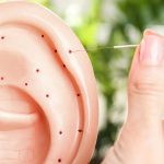 Auriculothérapie et acupuncture de l'oreille ?